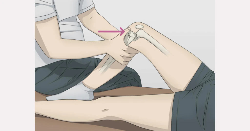 Các Test lâm sàng để phát hiện đứt Dây chằng chéo trước ACL