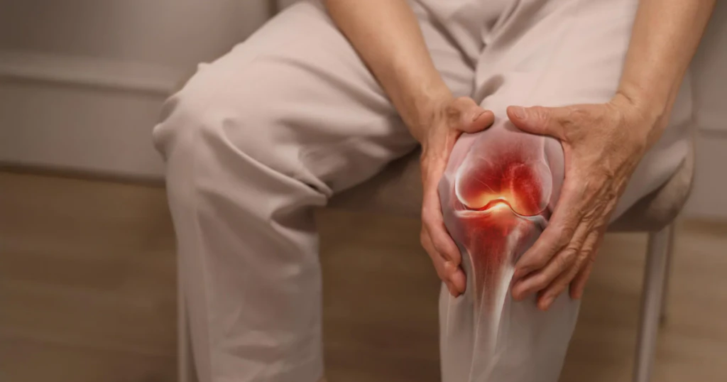 Những sai lầm phổ biến khi xử trí thoái hóa khớp gối
