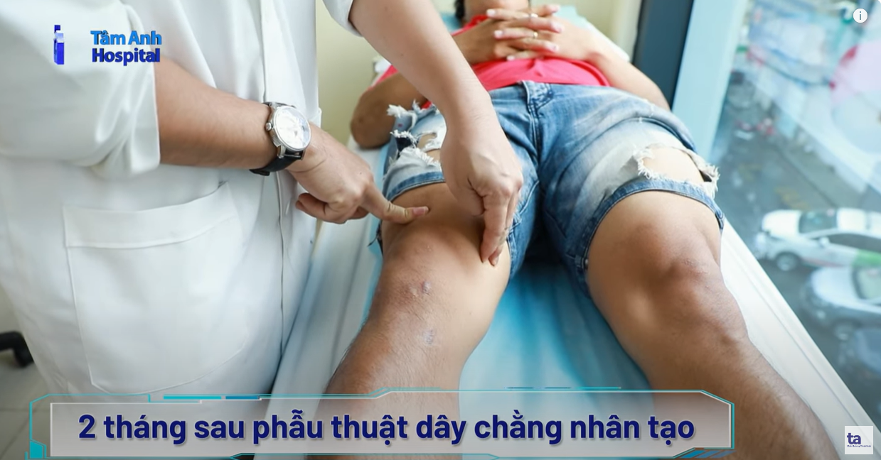 Dây chằng nhân tạo