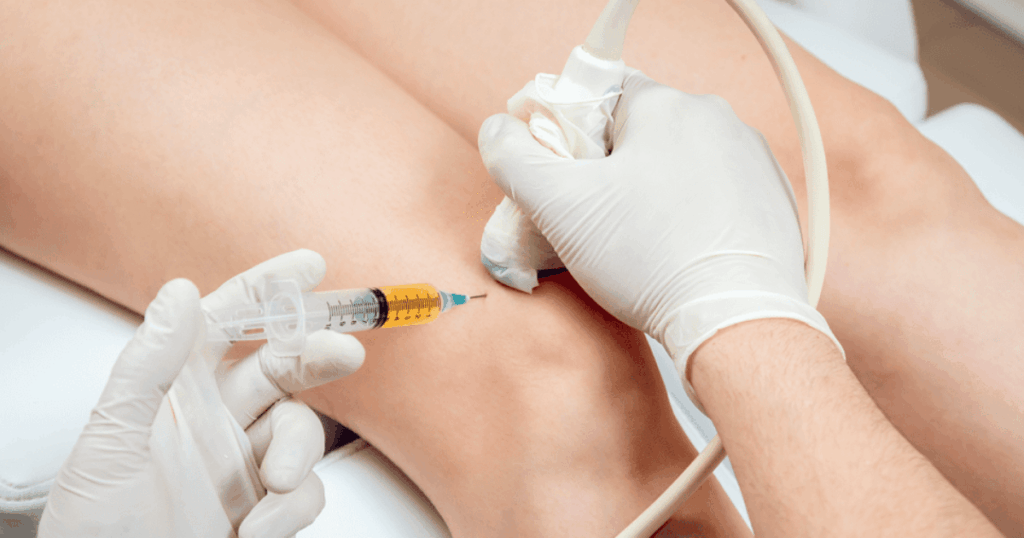 Điều trị nội khoa trong thoái hóa khớp gối