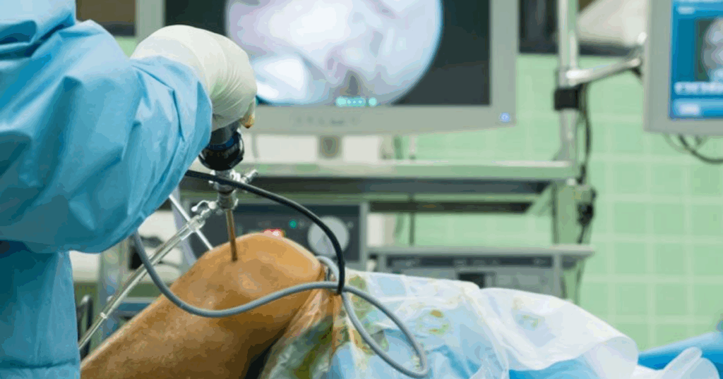 Tỉ lệ thành công sau mổ dây chằng chéo trước khớp gối và những yếu tố quyết định