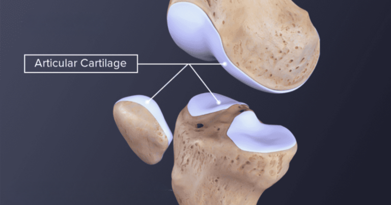 Sụn khớp và mối liên hệ với tuổi thọ của khớp gối