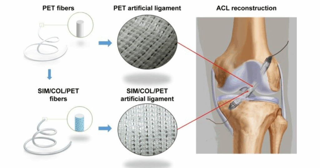 Cấu tạo sợi PET của dây chằng nhân tạo