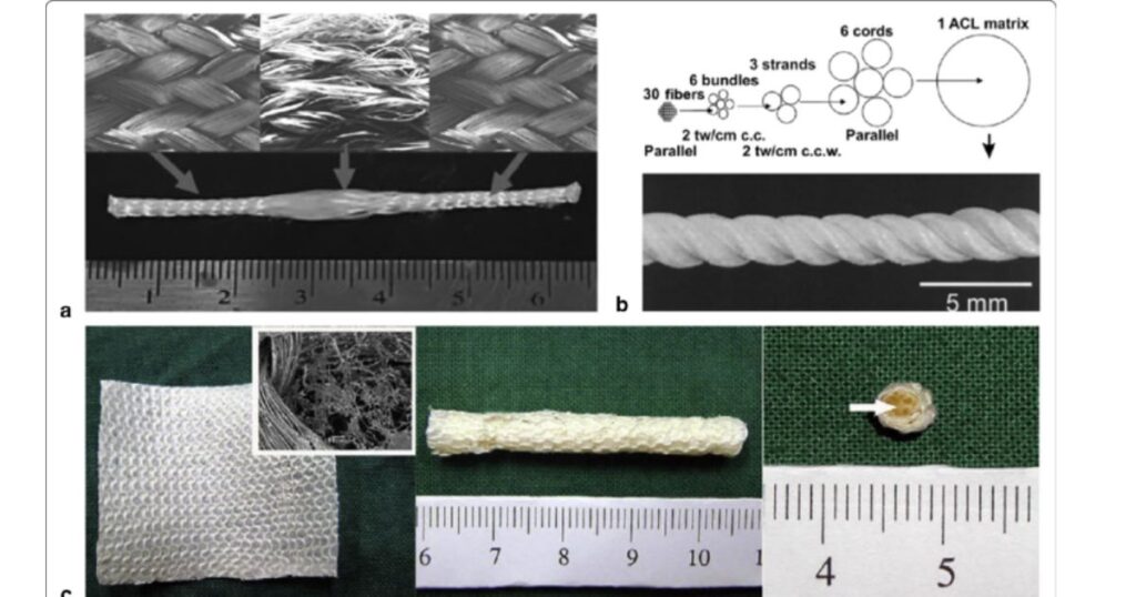 Vật liệu dây chằng nhân tạo có bị lão hoá theo thời gian không